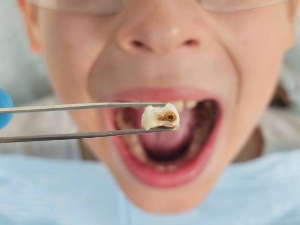 Best Emergency Treatment for Jaw Pain or Injury in South Coventry, CT